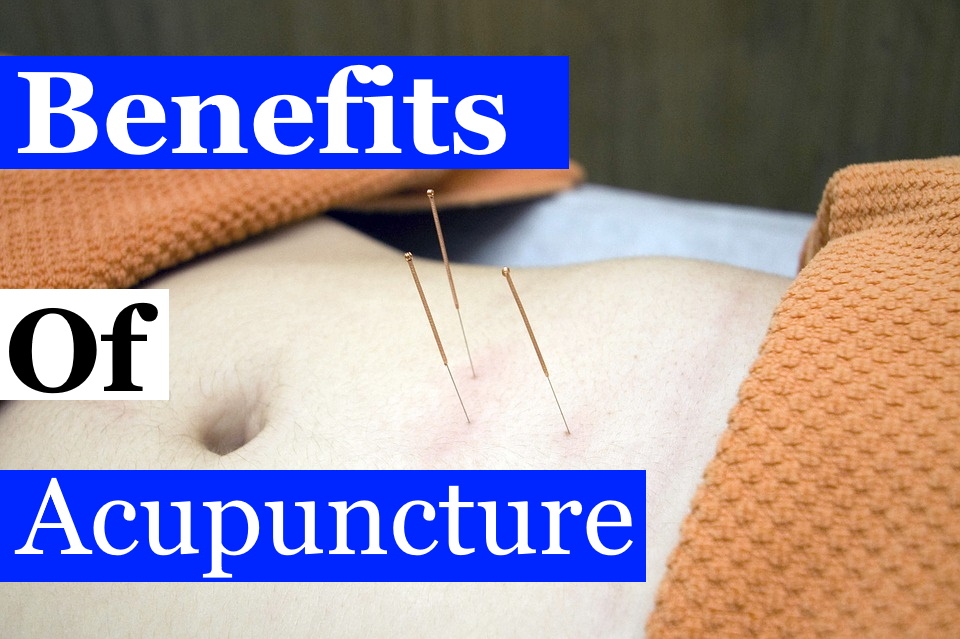 benefits of acupuncture how does it work
